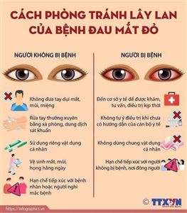 TRƯỜNG THCS LÁNG THƯỢNG TUYÊN TRUYỀN PHÒNG CHỐNG BỆNH ĐAU MẮT ĐỎ